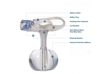 Silicone Mini Gastrostomy Button Tube 